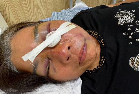 Điều tra vụ người đàn ông hành hung một phụ nữ 60 tuổi