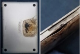 Máy tính MacBook Pro đột ngột bốc cháy khiến chủ nhân bị bỏng