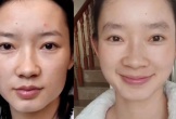 Làn da sau một năm bỏ uống trà sữa của cô gái khiến netizen bất ngờ