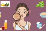 Mách bạn cách điều trị da mặt bị khô tróc vảy tại nhà