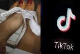 Pakistan: Cô gái 17 tuổi bị cha bắn tử vong vì không chịu xóa tài khoản TikTok