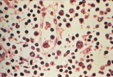 Đài Loan ghi nhận 1 ca tử vong do nhiễm virus Hanta