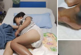 'Xương con nhức quá, mẹ làm sao cho chân con hết đau đi'